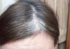 prevent premature gray hair
