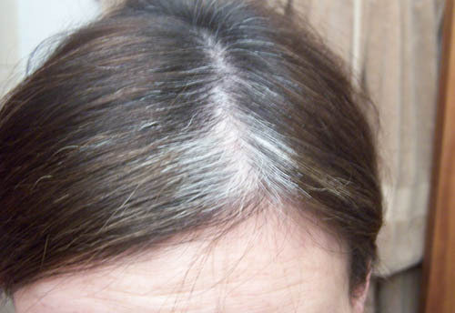 prevent premature gray hair