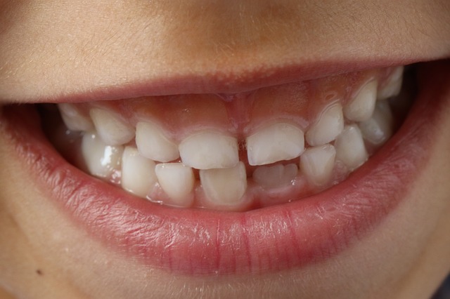 Teeth Sensitivity Home Remedies
